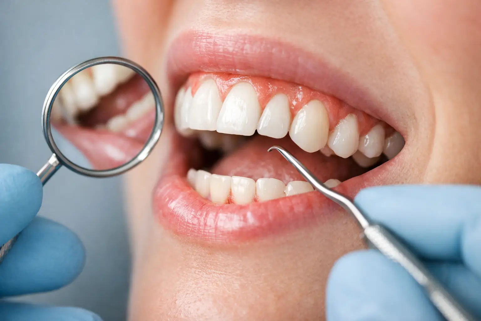 Early Signs Gum Recession to Watch For